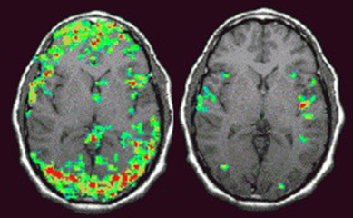 fMRI